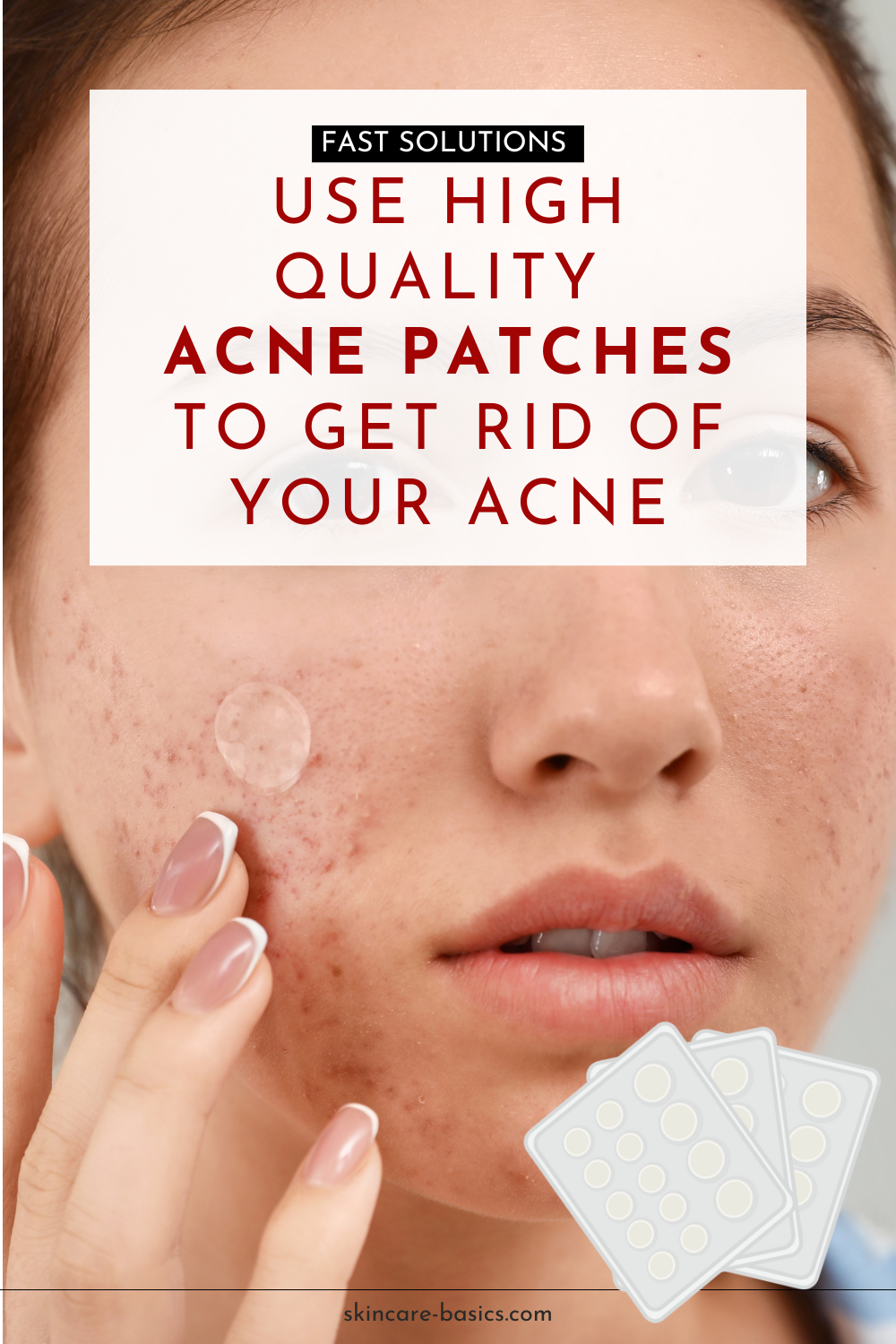 Best 5 Acne Patches We Strongly Recommended