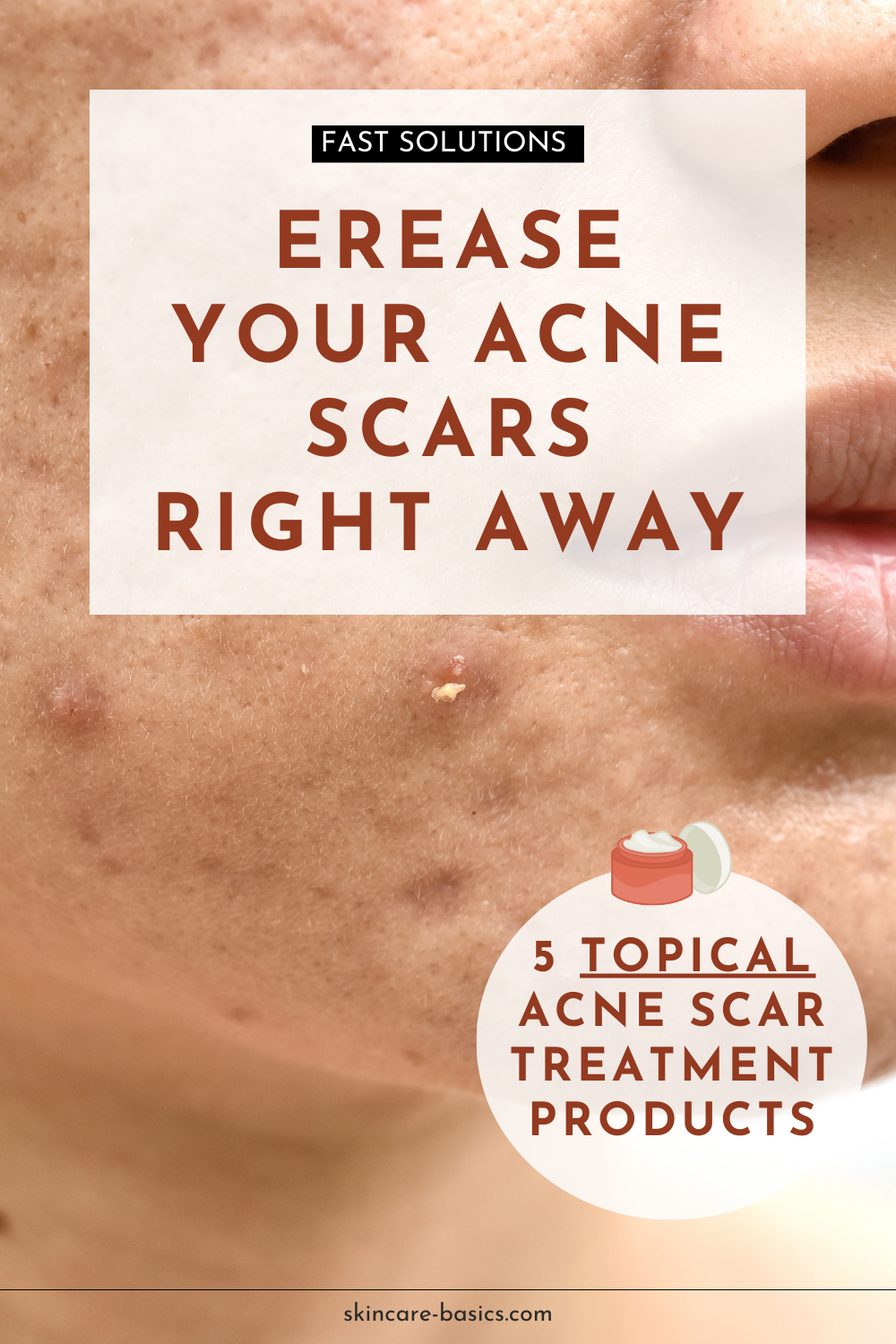 How to Treat Acne Scars with Topical Products?